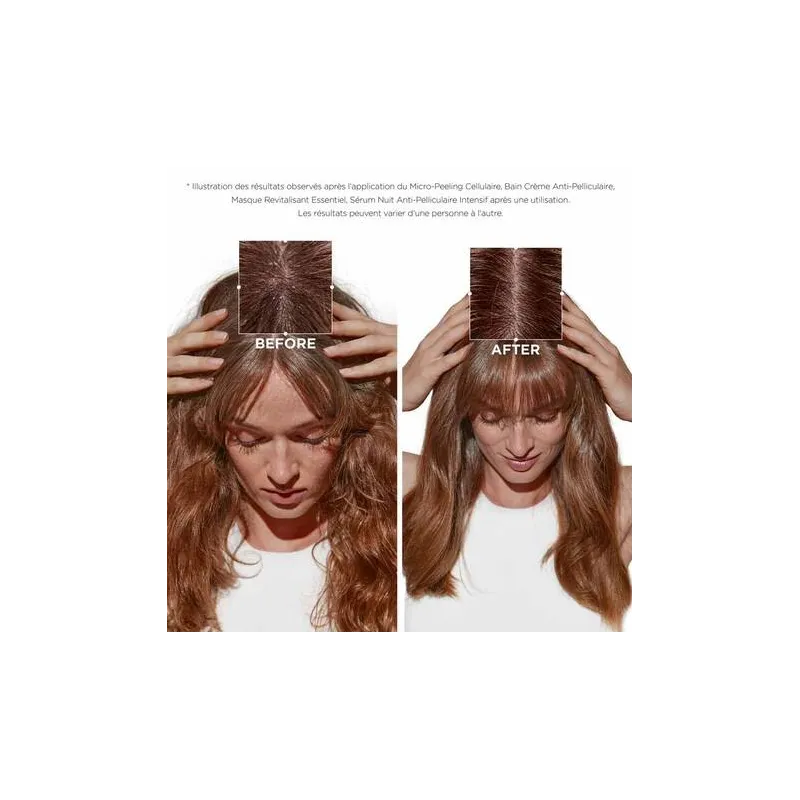 Bain Crème Anti-Pelliculaire Symbiose Kérastase 250ml, Mon Produit ...
